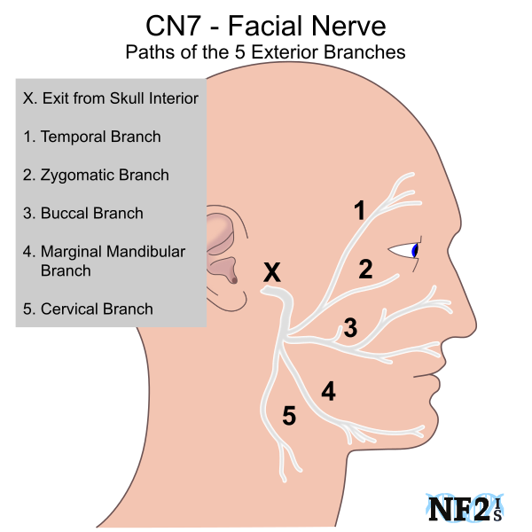 Facial Nerves Numbness 2