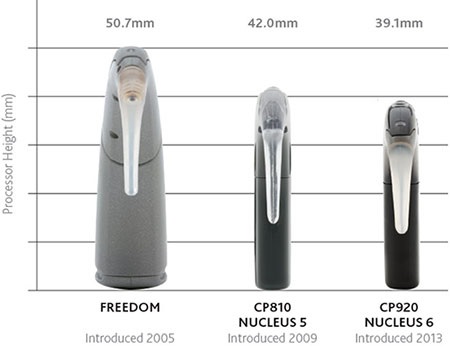 nucleus 5 cochlear implant